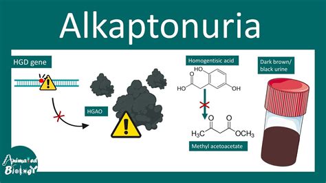 Alkaptonuria